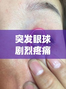 突发眼球剧烈疼痛，症状解析、诱因探究与应对良方
