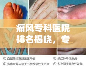 痛风专科医院排名揭晓，专业治疗助您摆脱疼痛困扰！