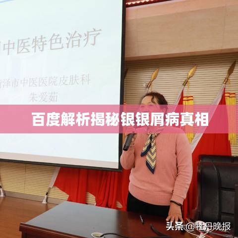 百度解析揭秘银银屑病真相