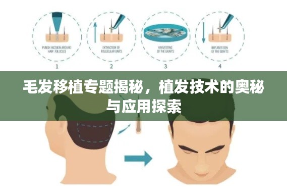 毛发移植专题揭秘，植发技术的奥秘与应用探索